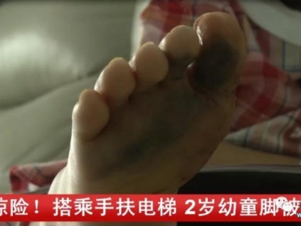 危險！2歲幼童搭乘手扶電梯，腳被卡進縫隙……