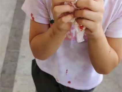 電梯頂?shù)袈湓覀?歲女孩致其流血?dú)?，賠償事宜難以達(dá)成