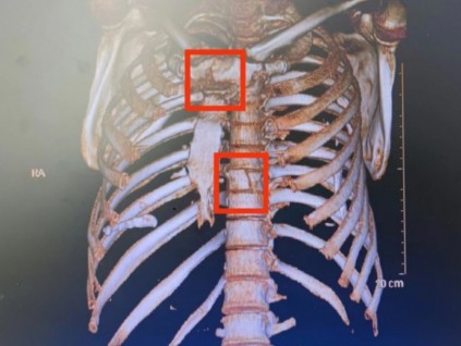 新電梯早新聞8月10日 七月十三 星期三